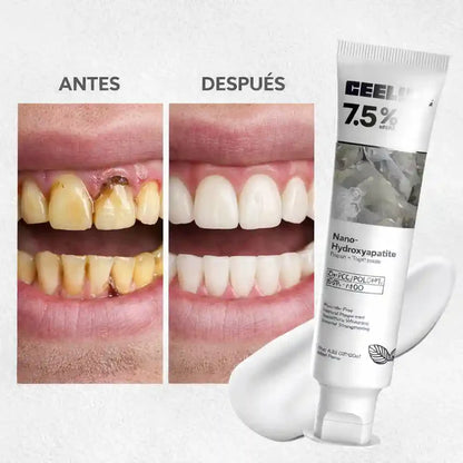 CEELIKE Nano-Hydroxyapatita 7.5%