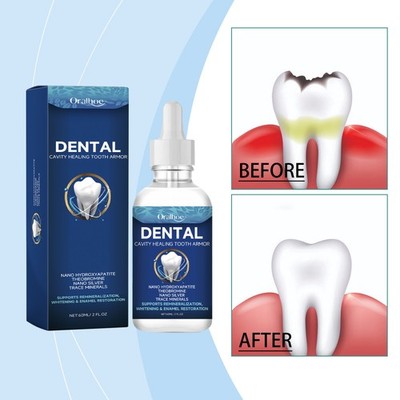 DENTAL CAVITY HEALING  30ML